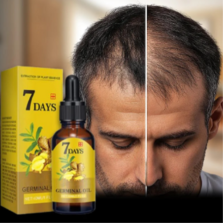 زيت انباث الشعر