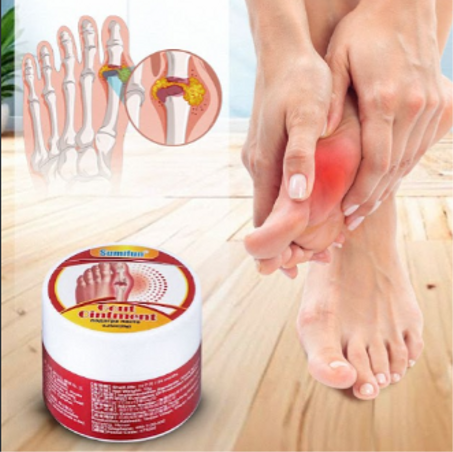 كريم لعلاج النقرس