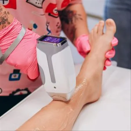 أجهزة إزالة الشعر