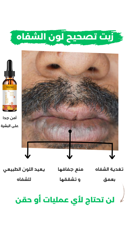 زيت تصحيح لون الشفاه