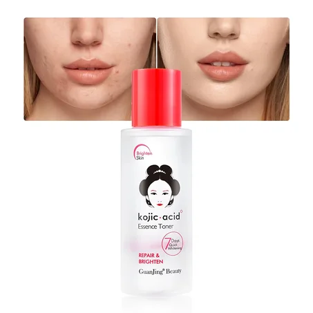تونر للوجه بحمض الكوجيك 100 مل