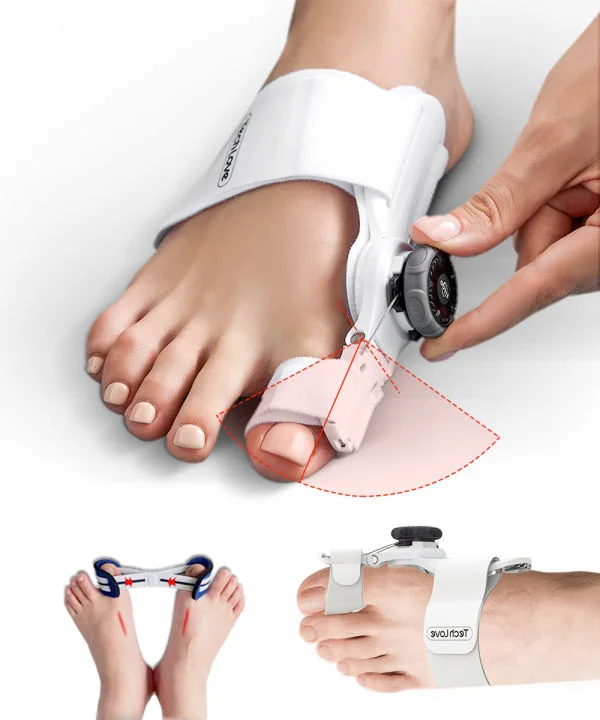 مصحح أصبع القدم الكبير