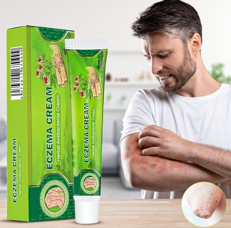 كريم لعلاج اكزيما و الحكة والصدفية