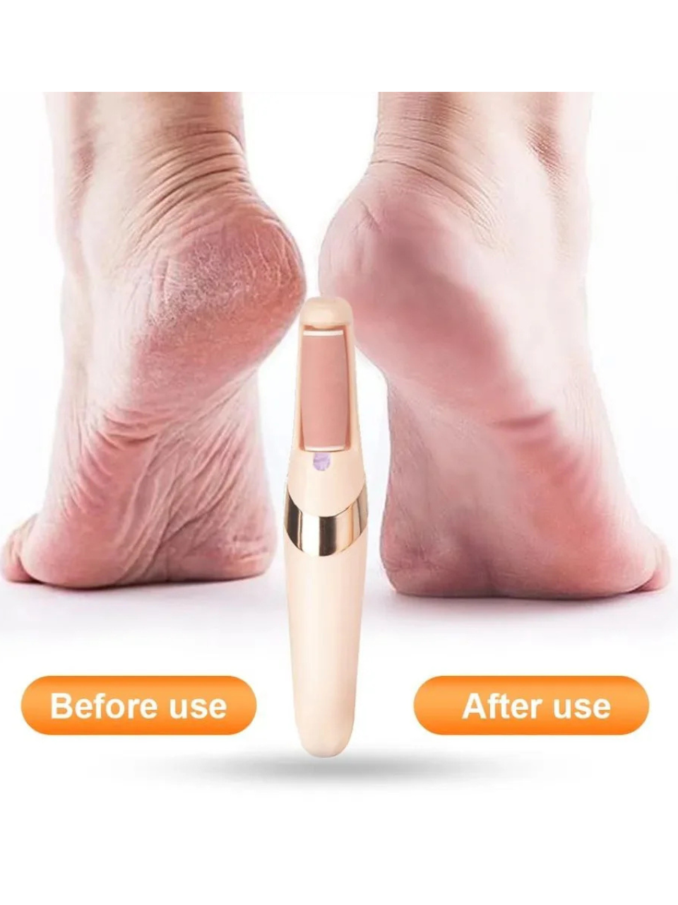 Electric Foot Grinder