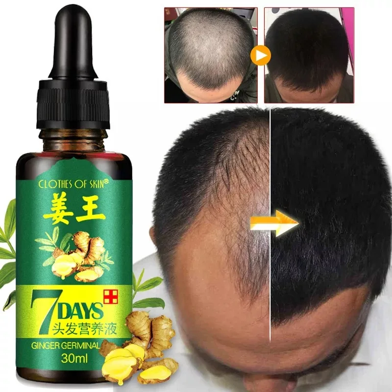 stores/a59bc3b38af202e464d451b58cdebb16/products/piFSNpJe2VZcFQcl8wdqDVtjaFWx7UrgmFIQWDhY.webp