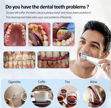 جهاز ازالة الجير المميز