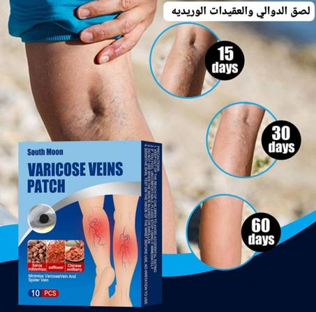 لصقات لتخفيف الدوالي وتورم الأوردة الطبي 💯👍