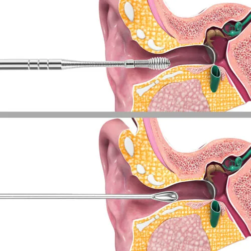 Earwax cleaning kit x6  قطع طقم تنظيف شمع الأذن