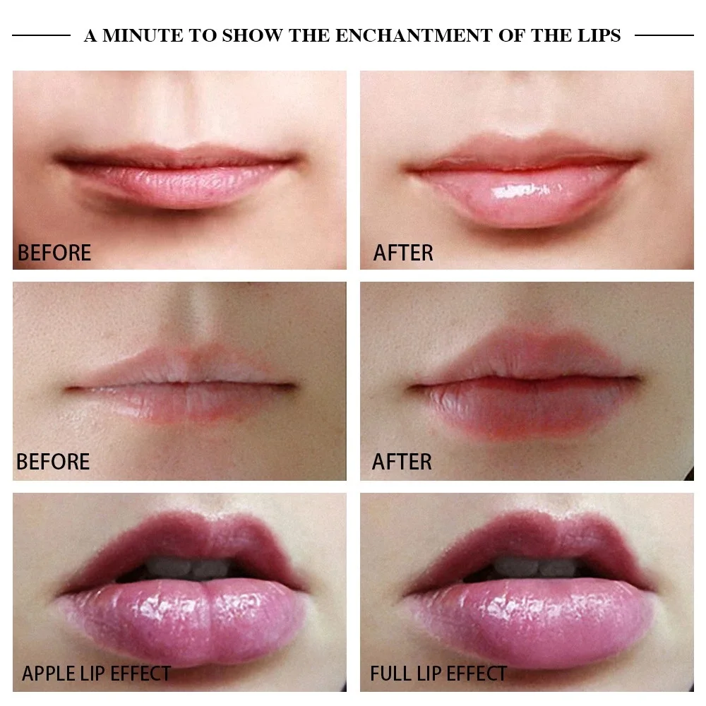 Electric Lip Plumper Device جهاز تكبير الشفاه الكهربائي