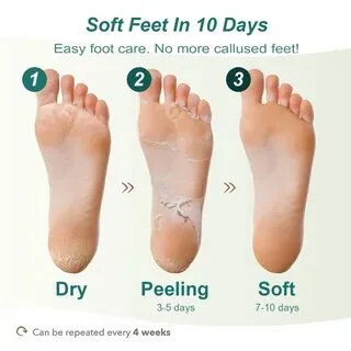 قناع تقشير القدمين