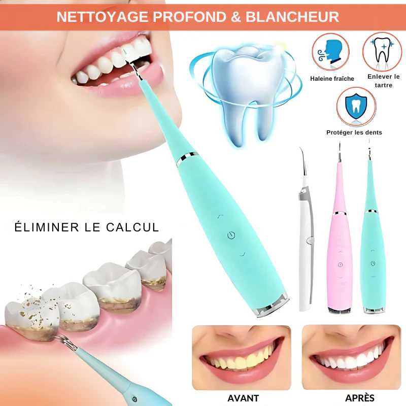 Detartant dentare