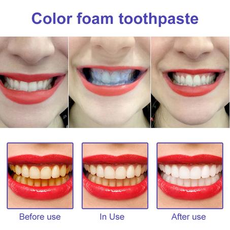 Purple Whitening Toothpaste