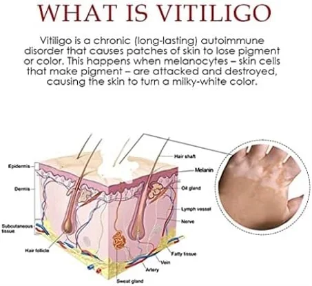 Spray anti-taches blanches  s