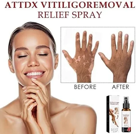 Spray anti-taches blanches c