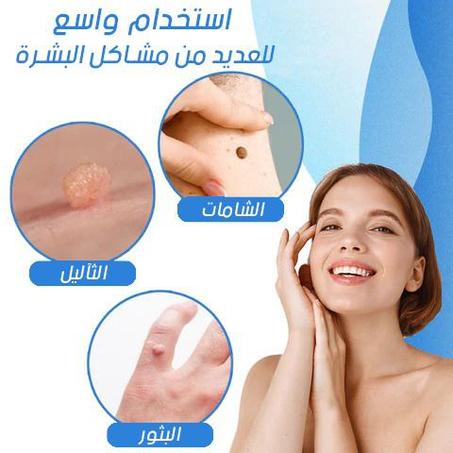 جهاز مزيل التولال