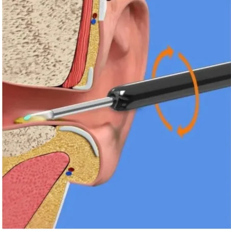 جهاز منظف الأذن