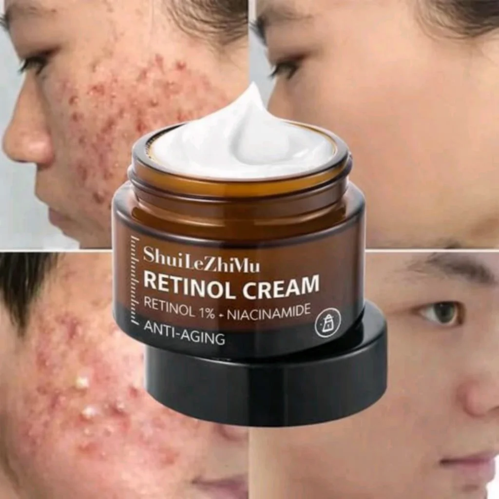 Crème retinol anti rides