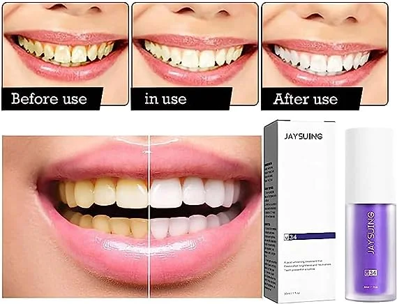 معجون تبيض الأسنان. V34