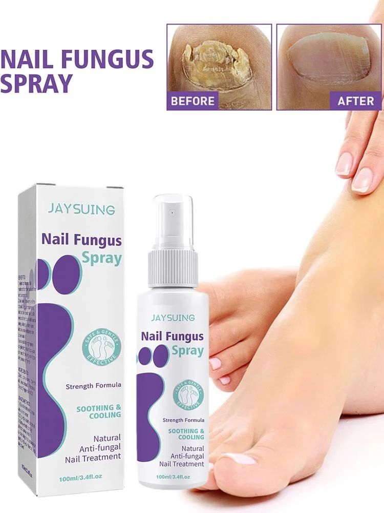 بخاخ سيروم للعناية بالفطريات والأظافر