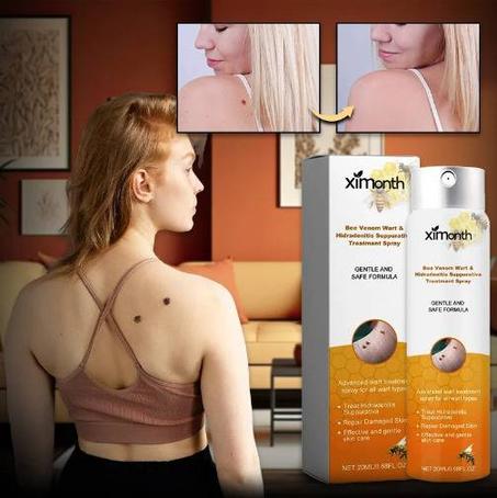 بخاخ سم النحل لعلاج التأليل