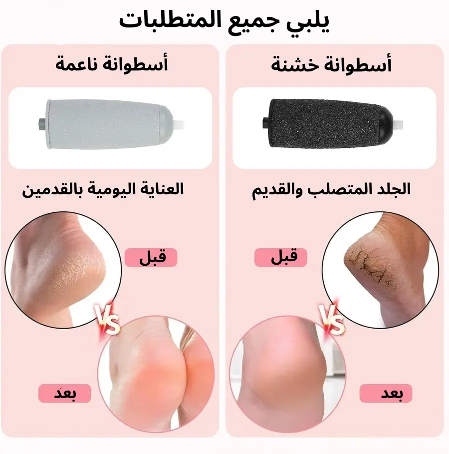✨ جهاز إزالة الجلد الميت للقدمين