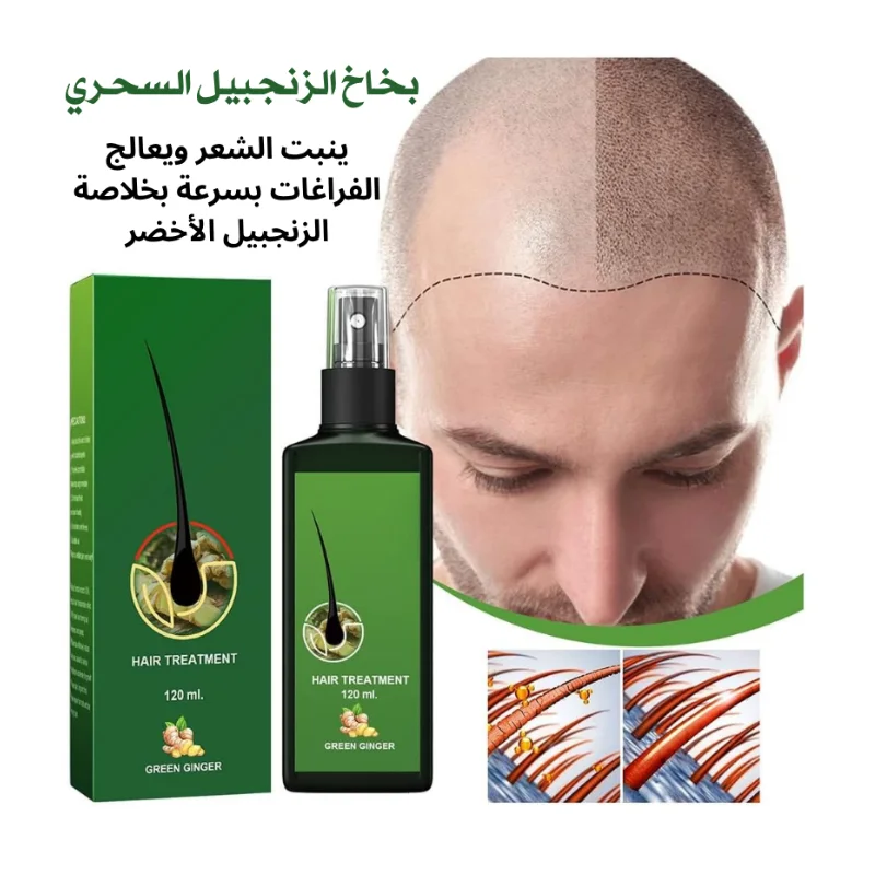 Ginger hair spray (بخاخ الزنجبيل السحري)