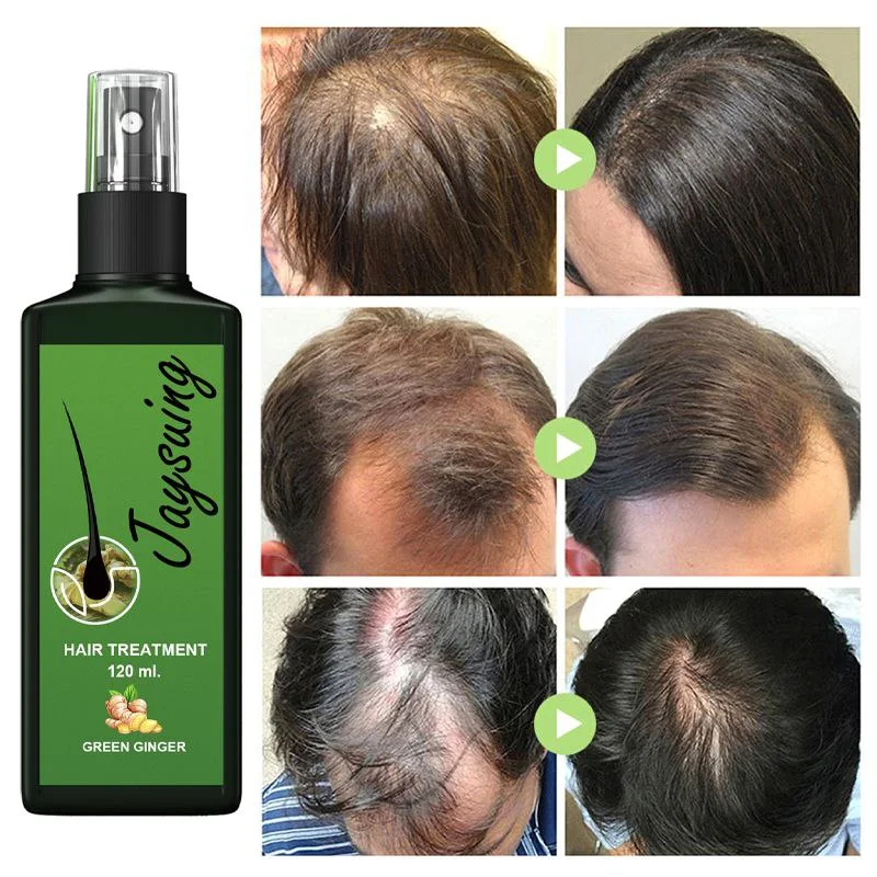 Ginger hair spray (بخاخ الزنجبيل السحري)