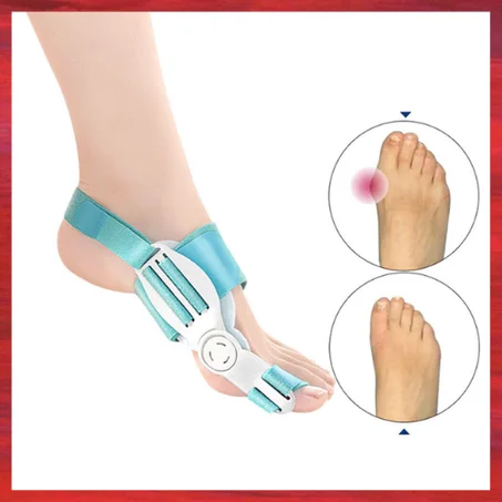 Advanced hallux valgus bunion aid splint - FeetiFix