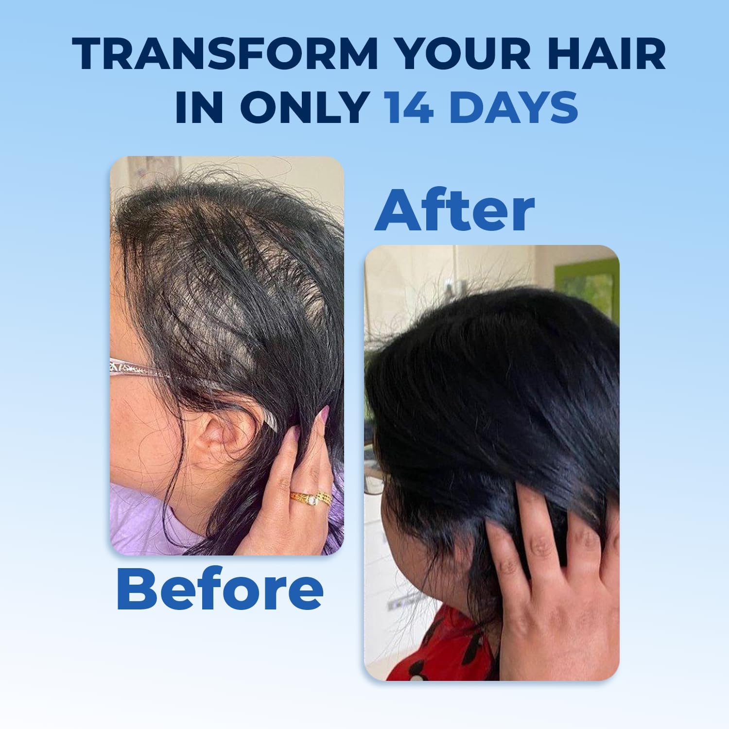 FEG Hair Growth Spray – 50ml