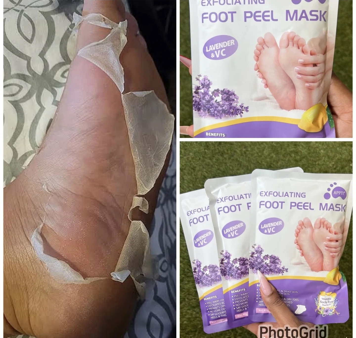 ⭐​⭐​⭐​⭐​⭐​  +2750 clientes satisfaites FOOT PEEL MASK™ - Retrouvez maintenant vos jolis pieds de bébé !