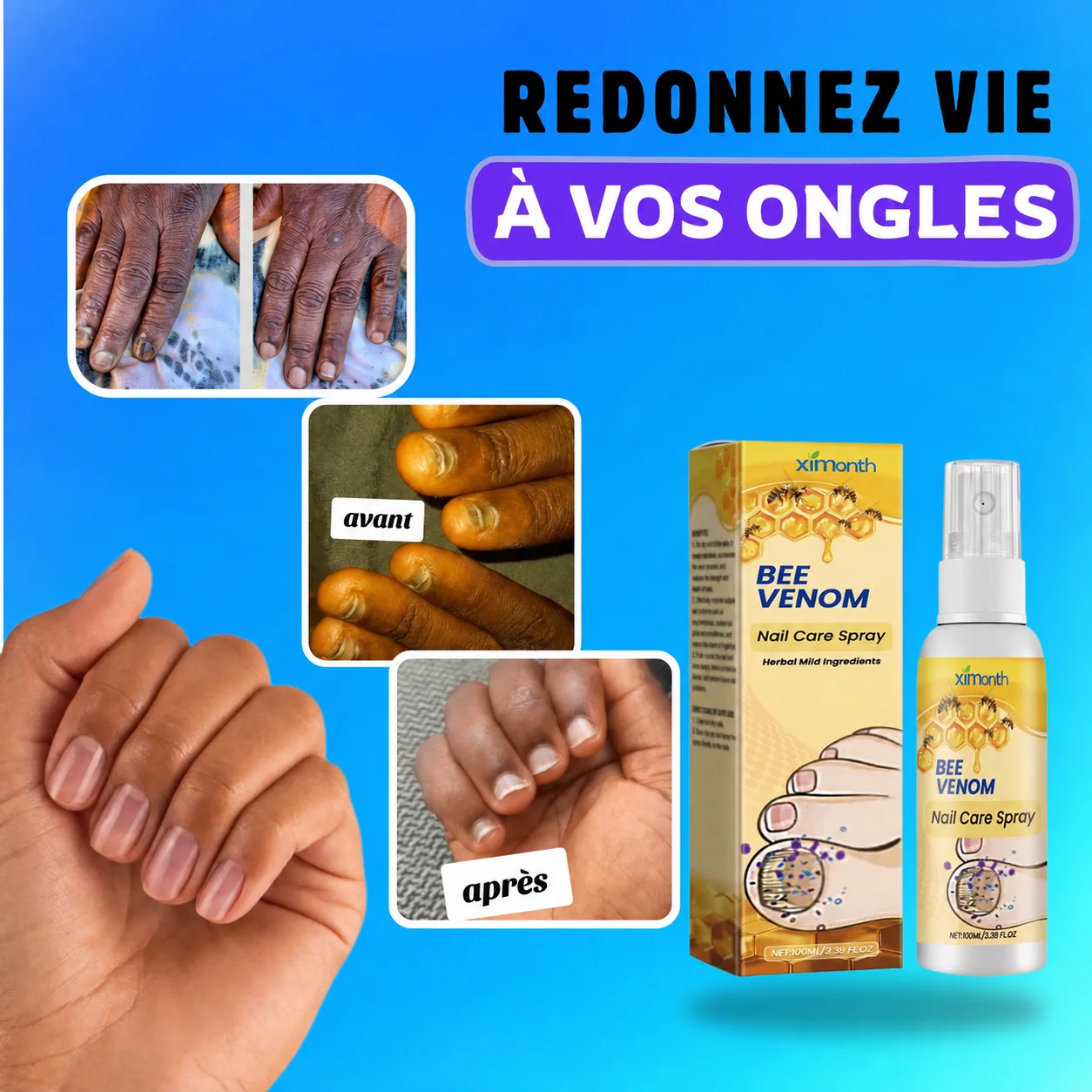 REPAREZ VOS ONGLES EN 7 JOURS  AVEC BEEVENOM®   ⭐⭐⭐⭐⭐