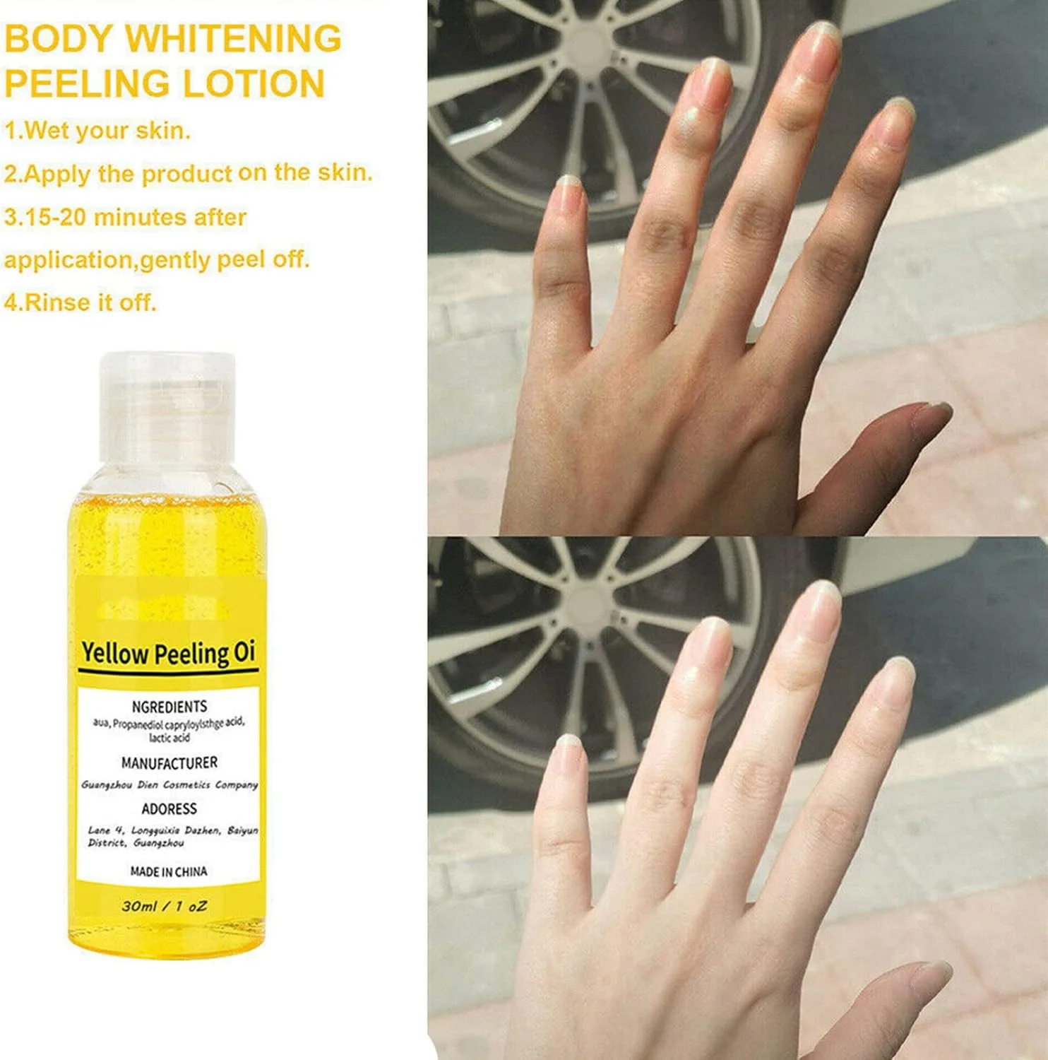 زيت تقشير الجلد الميت السحري