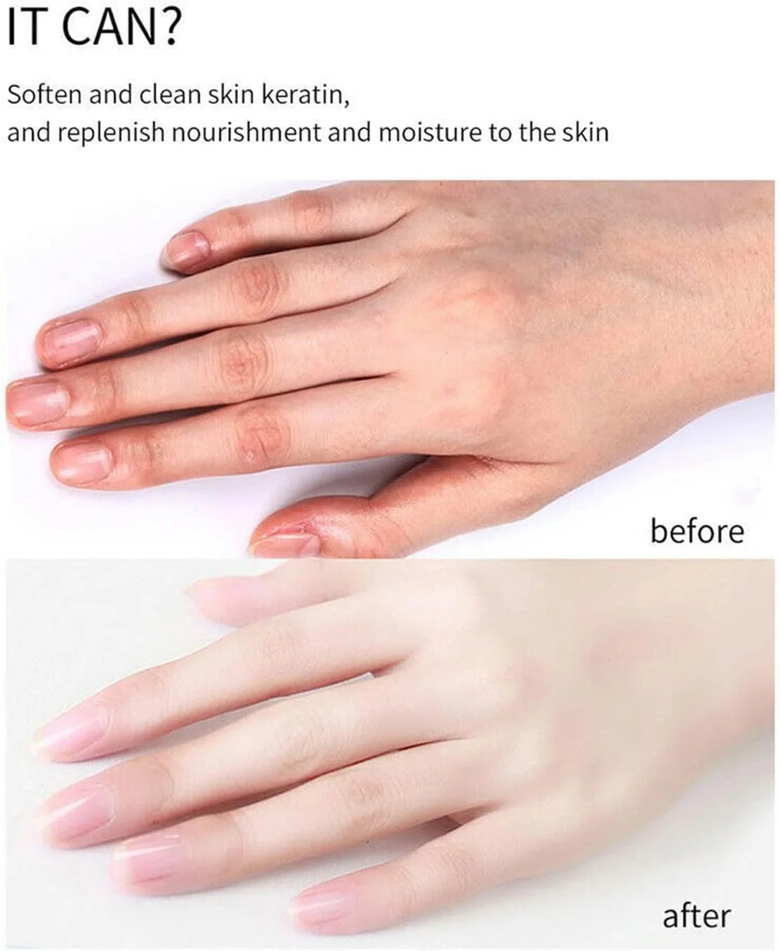 زيت تقشير الجلد الميت السحري