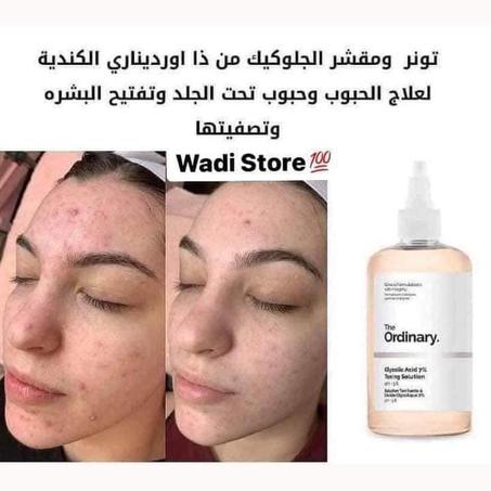 ذا اورديناري تونر مقشر لتفتيح البشرة،
