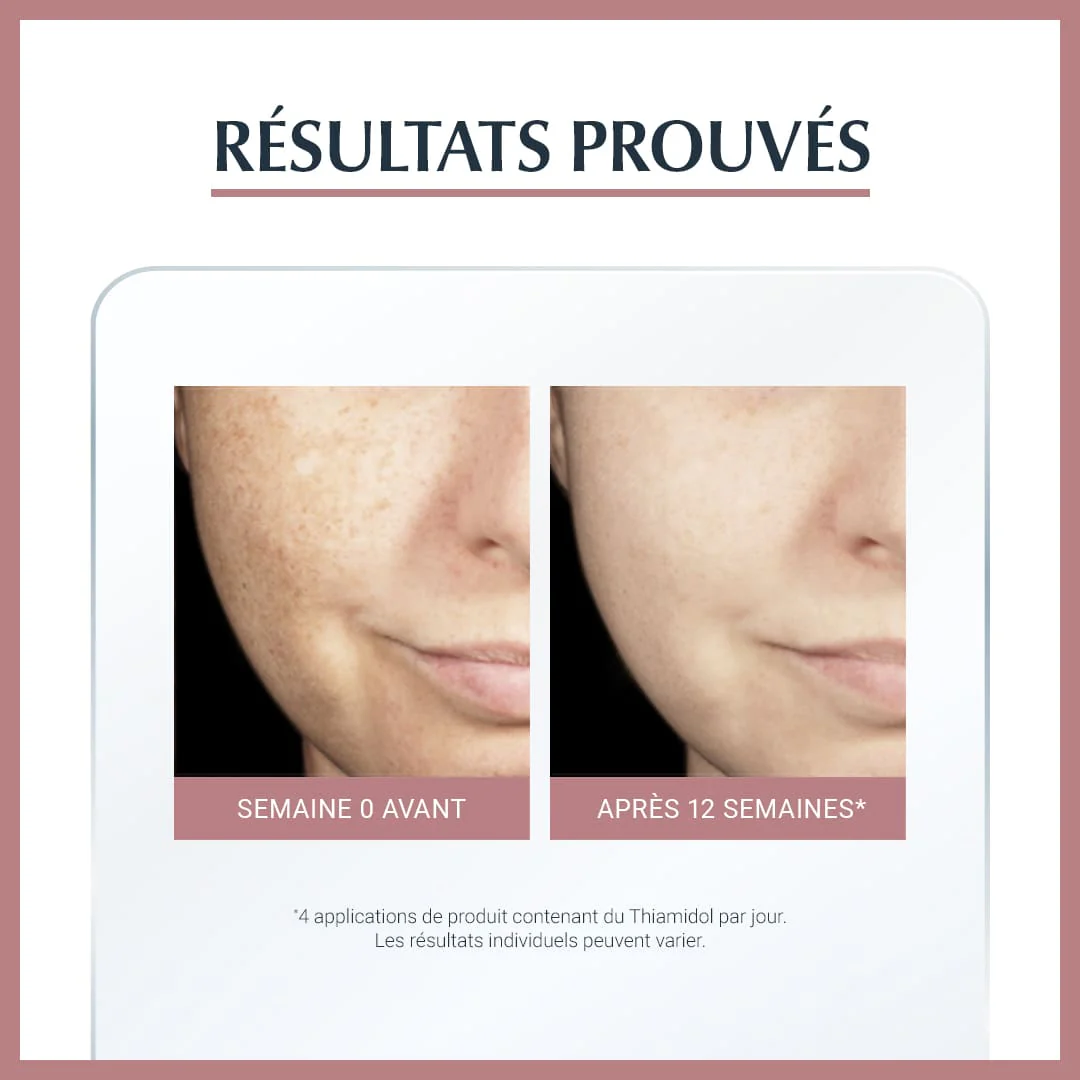 EUCERIN ANTI PIGMENT SERUM ECLAT 30ML