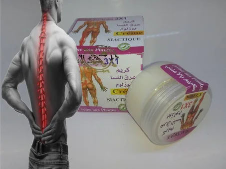 عرق النساSciatique