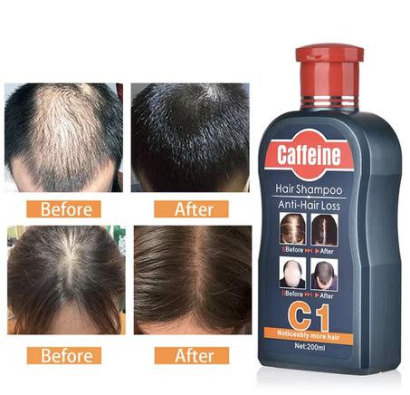 شامبو مضاد لتساقط الشعر