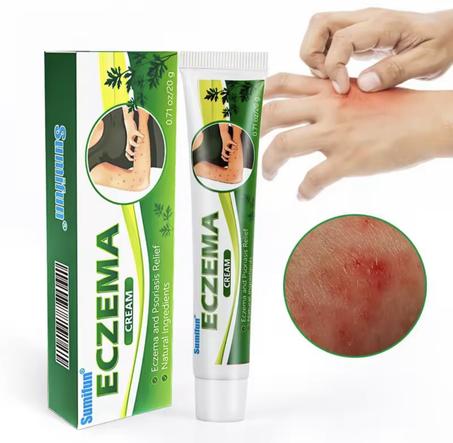 كريم الأكزيما و الصدفية