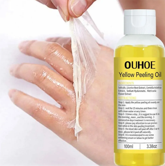 زيت التقشير الذهبي