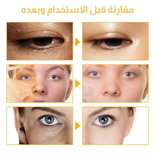 زيت التقشير الذهبي