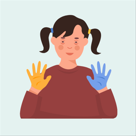 تأهيل أطفال متلازمة التثلث الصبغي