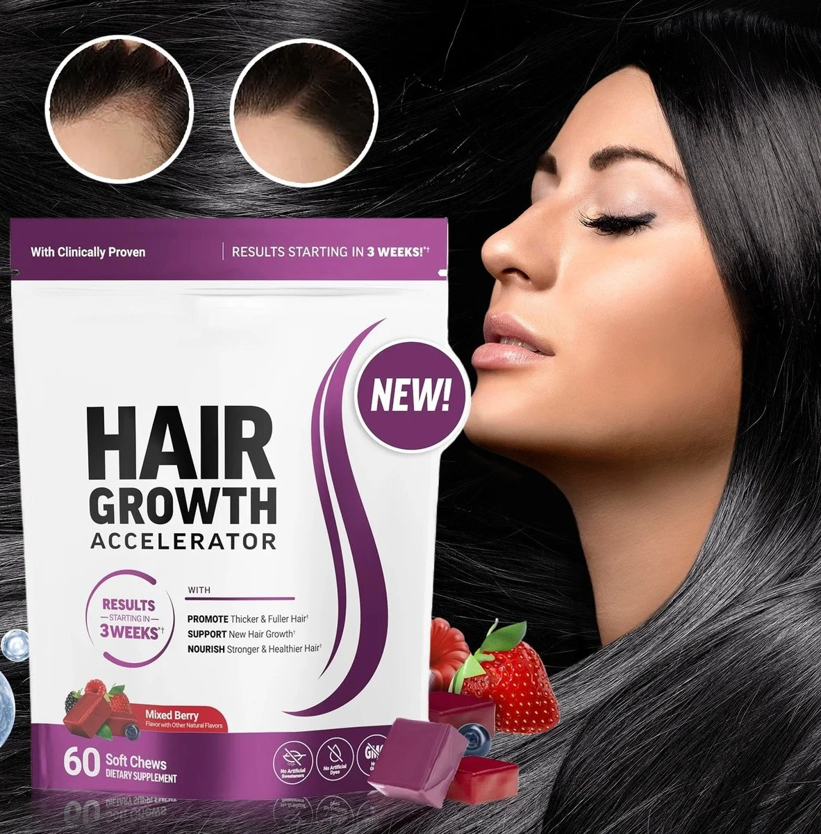 Hair Growth