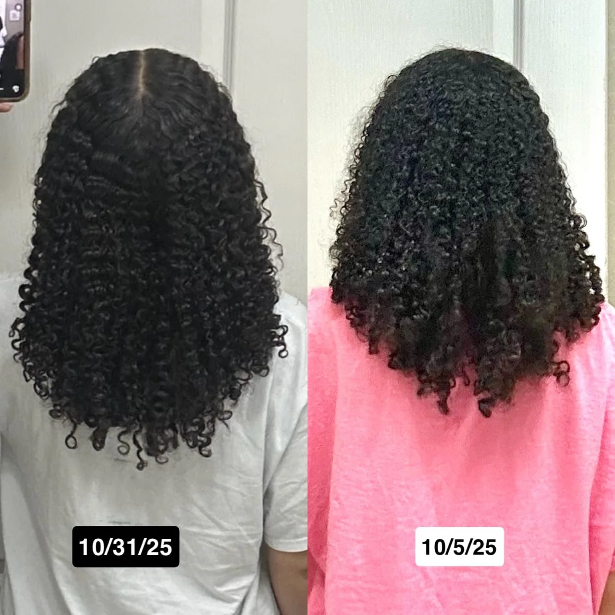 Hair Growth