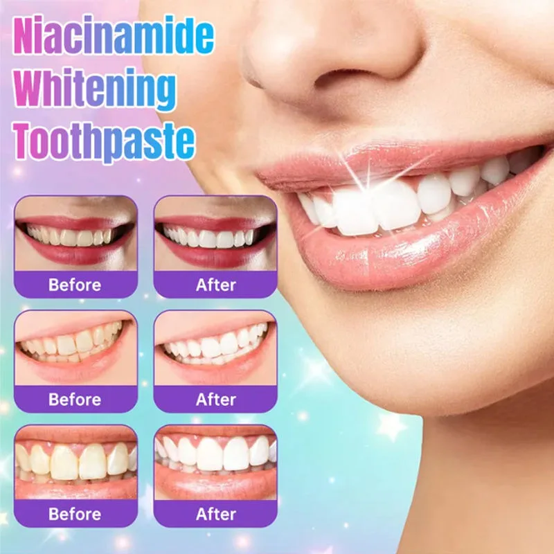 Dentifrice Niacinamide