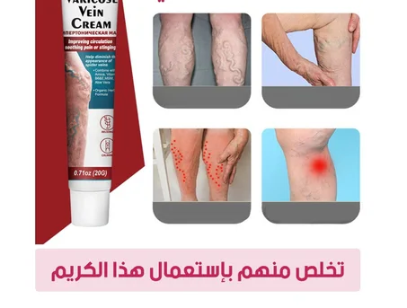 Crème Pour Soulager La Vascularite