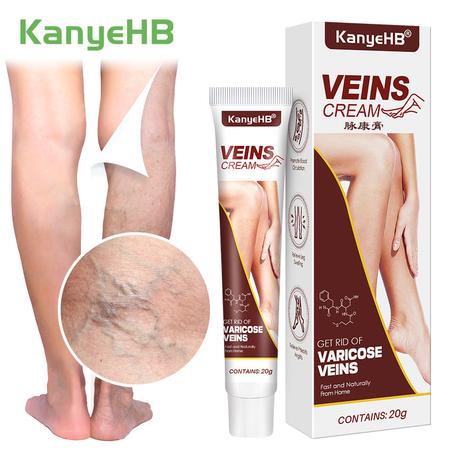 Varicose Veins Relief Cream كريم تخفيف دوالي الأوردة