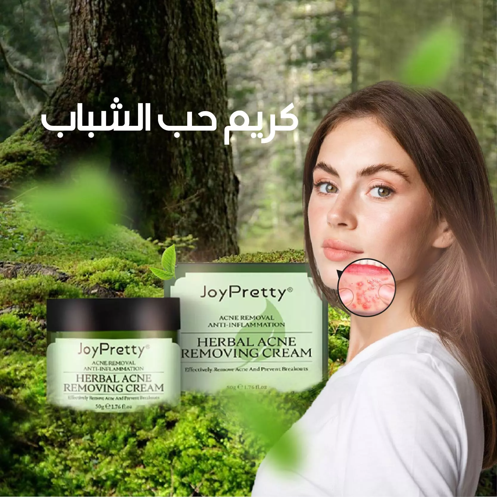 Acne Protection Cream كريم حماية من حب الشباب