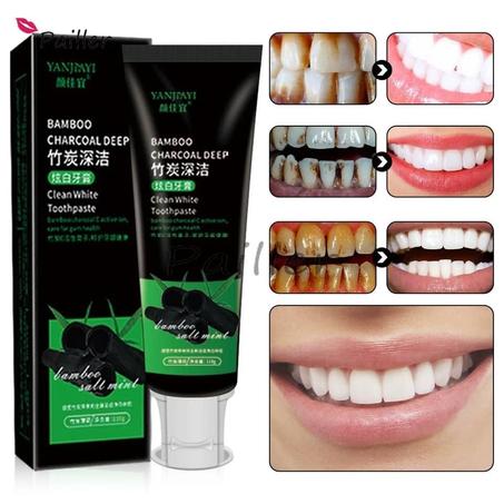 معجون تبييض الأسنان🦷