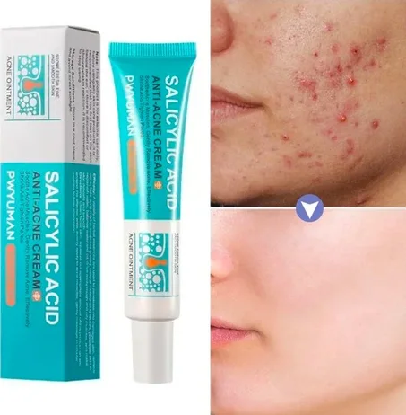 كريم الساليسيليك