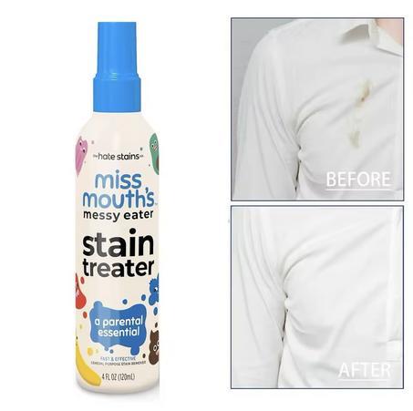 Stain Snap -  الحل السحري لإزالة البقع  في أي وقت وأي مكان!  (120 مل)